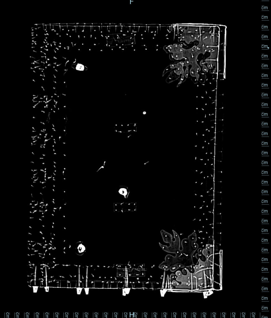 Still image from CT scan