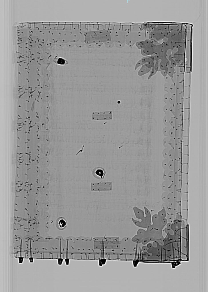 Still image from CT scan